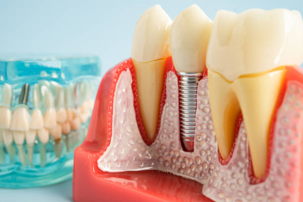 Trusted Post, TX  Dental Services Experts